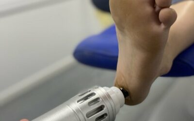 Shockwave therapy NOW available